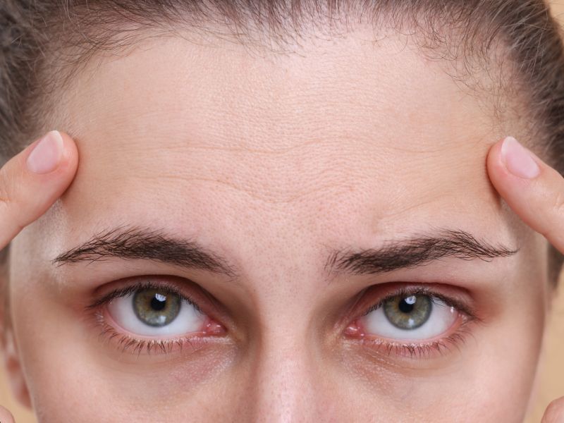 קמטים בפנים